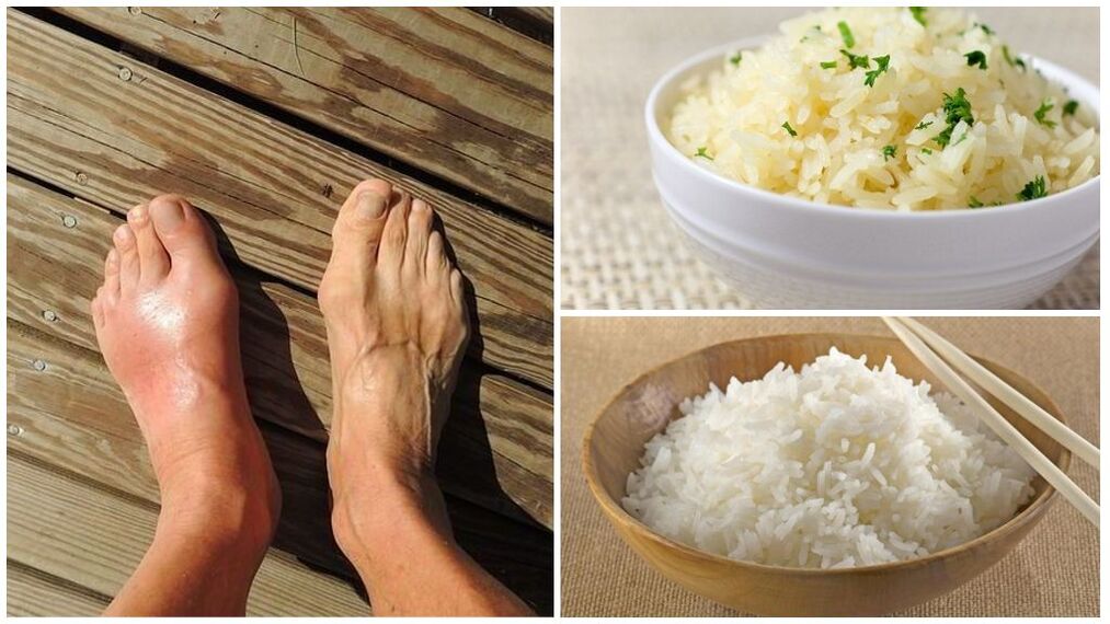 Bolesnicima od gihta preporučuje se dijeta na bazi riže. 